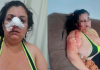 Mulher é vítima de tentativa de feminicídio em Sombrio