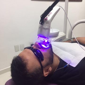 Clareamento dental: o que você precisa saber