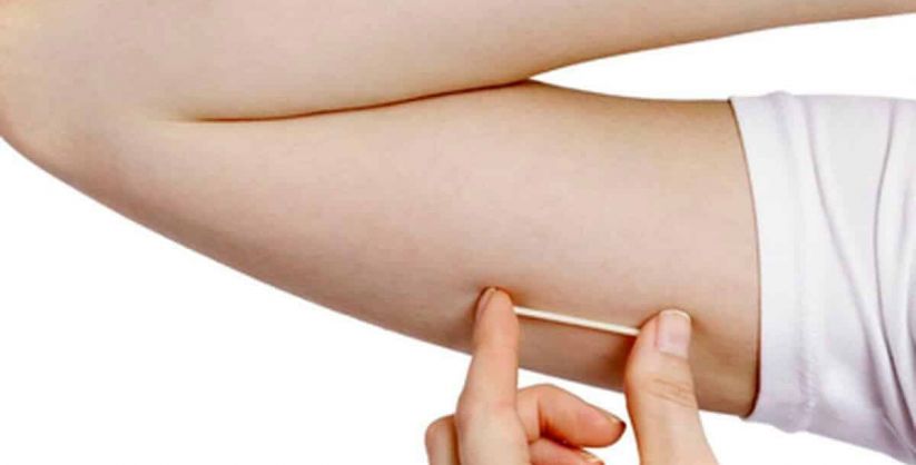 Balneário Gaivota amplia rede de cuidados e passa a oferecer o método contraceptivo Implanon no SUS